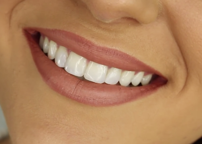 healthy_smiling_teeth